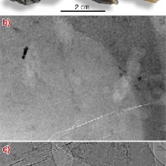 a) Différentes variétés de l'ambre opaque crétacé des Charentes, de couleur miel et un peu translucide ou brun laiteux plus ou moins sombre ; b et c) microradiographies d'un morceau d'ambre opaque, par b) imagerie d'absorption et (c) contraste de phase, révélant, à droite et à gauche, les silhouettes de deux insectes. 

© M. Lak, P. Tafforeau, D. Néraudeau (ESRF Grenoble et UMR CNRS 6118 Rennes).[...]