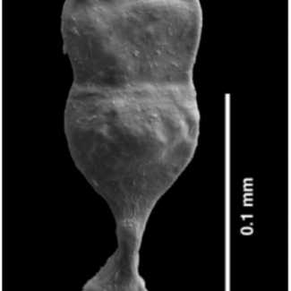 Spécimen malformé de chitinozoaire, un fossile de micro-zooplancton du Silurien du genre Margachitina.
© Thijs Vandenbroucke
[...]