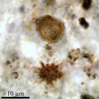 Microphotographies (microscopie optique en lame mince) de microfossiles organiques vieux de presque 2 milliards d'années préservés morphologiquement et chimiquement au sein des cherts de Gunflint. © Sylvain Bernard, Institut de minéralogie, de physique des matériaux et de cosmochimie (CNRS/MNHN/UPMC/IRD). 
[...]