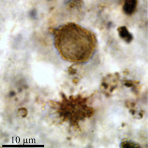 Microphotographies (microscopie optique en lame mince) de microfossiles organiques vieux de presque 2 milliards d'années préservés morphologiquement et chimiquement au sein des cherts de Gunflint. © Sylvain Bernard, Institut de minéralogie, de physique des matériaux et de cosmochimie (CNRS/MNHN/UPMC/IRD). 
[...]