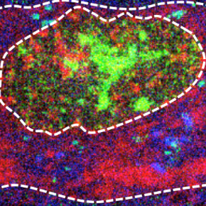 Image de la composition en P/Fe/S d’une coupe de neurone de la substantia nigra. Le corps du neurone et de son noyau sont contourés par une ligne en tiretés. Des granules cytosoliques riches en fer et en soufre sont pointées par des flèches.  